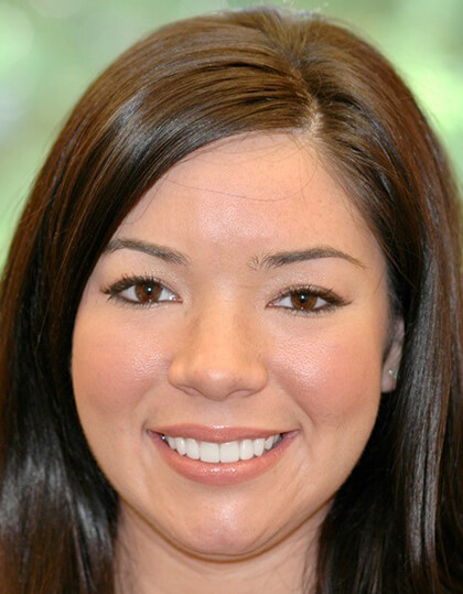 Young woman with flawless smile after porcelain veneers