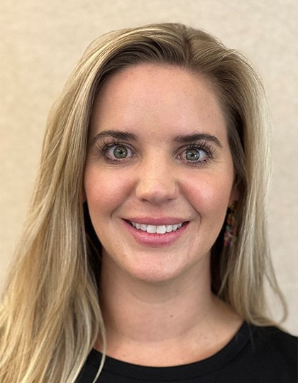 Young woman with imperfect smile before porcelain veneers