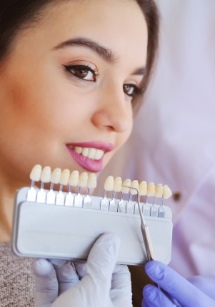 Woman's smile compared with porcelain veneer shade chart