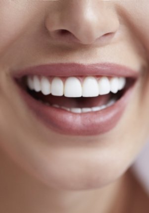Closeup of patient's flawless smile after teeth whitening